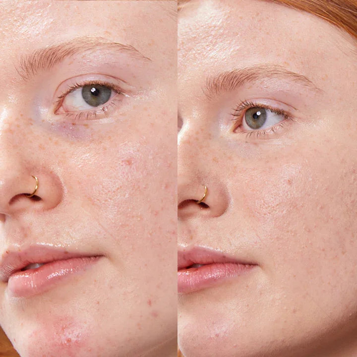 Concealer Balm Nr. 4 Oat Vorher-Nachher - Abdeckung von Unreinheiten und Augenringen