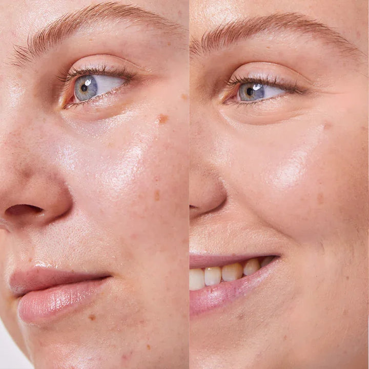 Concealer Balm Nr. 4.5 Seashell Vorher-Nachher - natürliche Abdeckung für alle Hauttypen