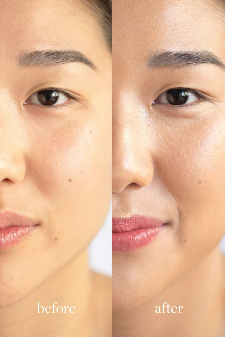 Ere Perez Lychee Crème Corrector Dos Before After - ein schöner Unterschied