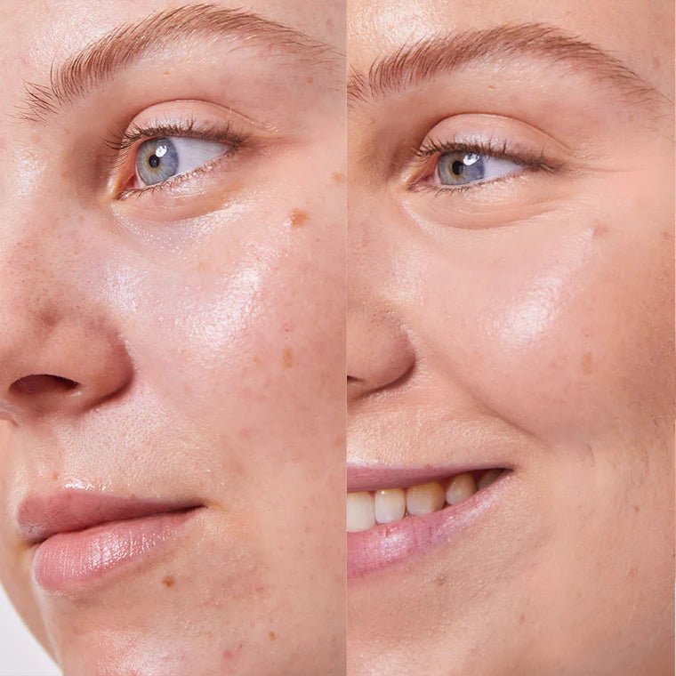 Concealer Balm Nr. 4.5 Seashell Model Before After